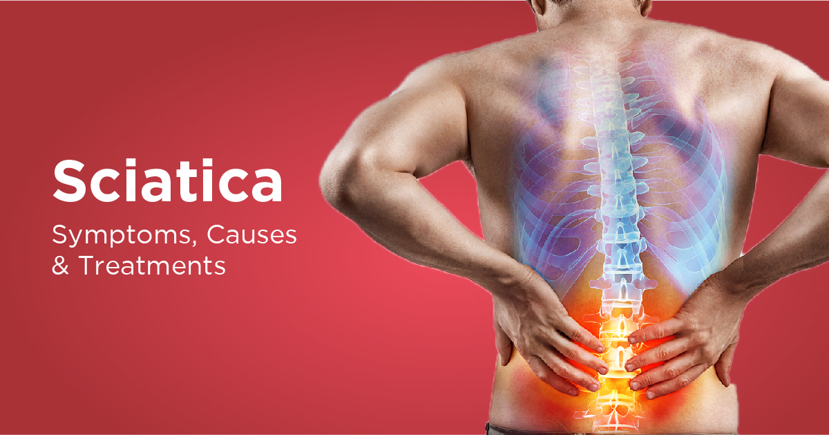 Sciatica Treatment in New Rajendra Nagar