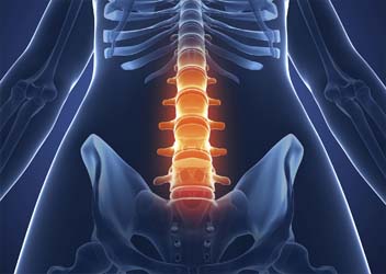 spondylitis treatment in central delhi